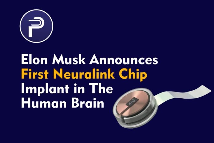 Elon Musk Announces First Neuralink Chip Implant in The Human Brain Elon Musk Announces First Neuralink Chip Implant in The Human Brain